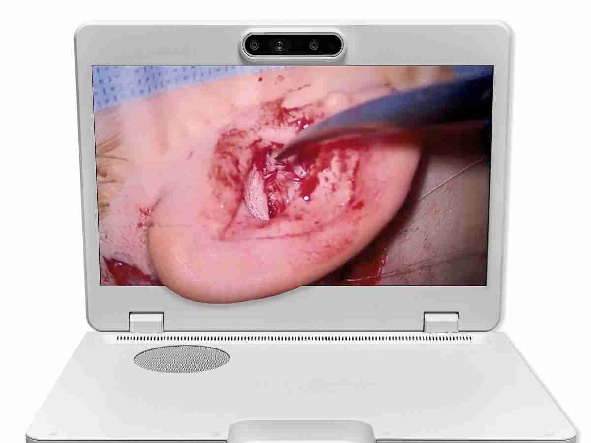 达擎之＂Heads-up 3D显微手术显示系统＂，，整合4K裸眼3D显示及眼球追踪系统，，，，具备快速追踪人眼移动位置功能，，减轻医师长时间维持固定姿势的负担，，让医师能有更宽广清晰的3D立体视野及更舒适的姿势来执行手术。。。